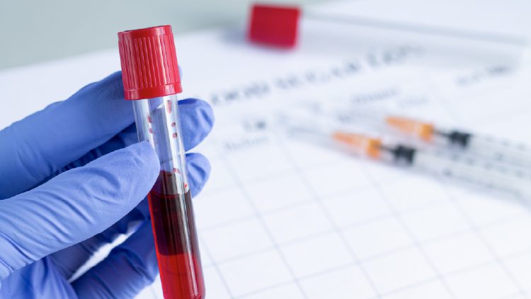 How to Get a Certified Translation of Blood Results